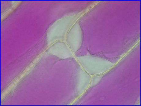 plasmolyse